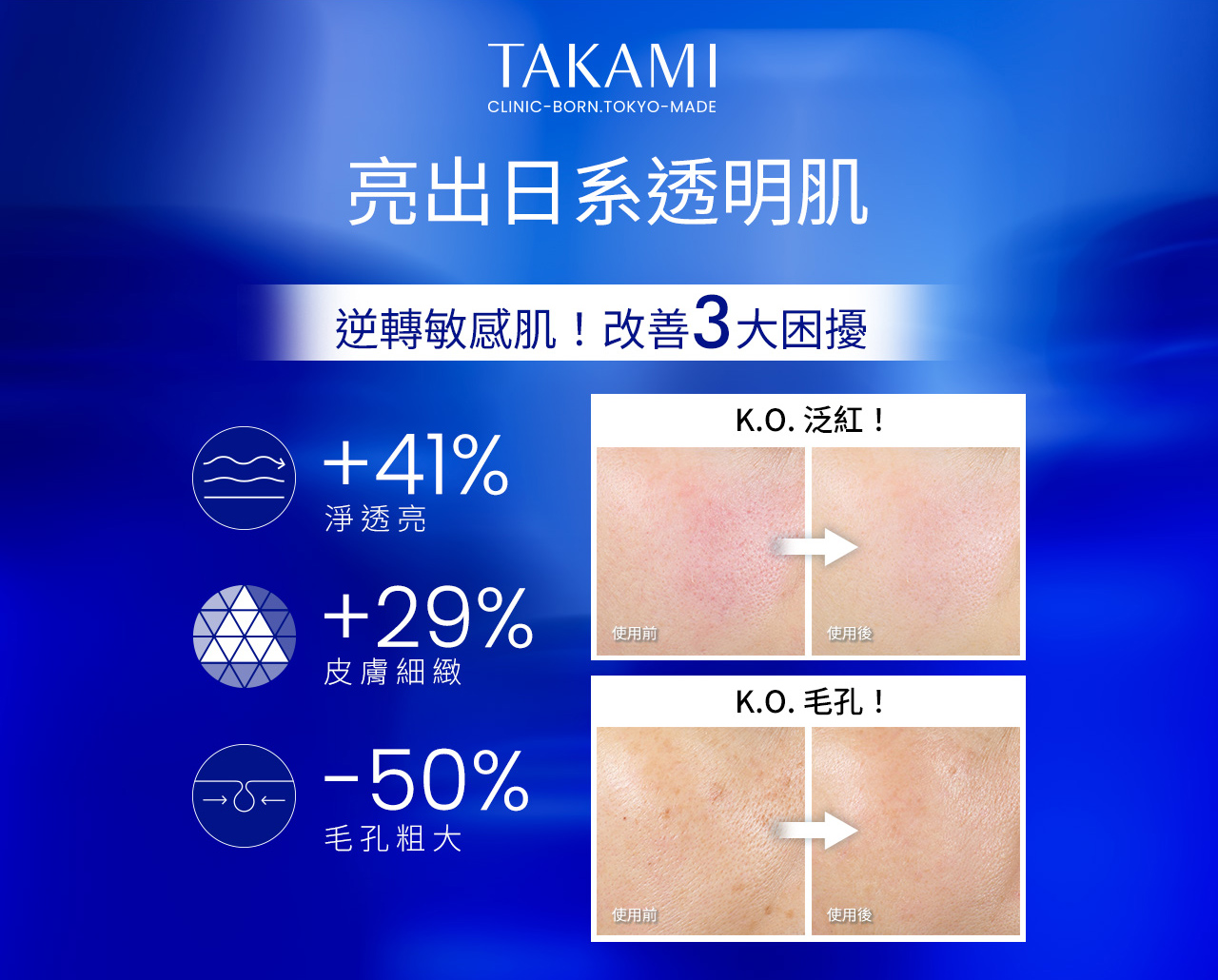 亮出日系透明肌